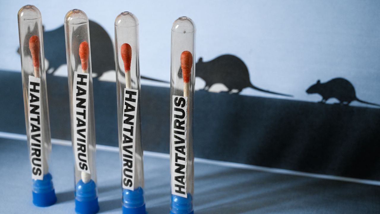 Ministerio de Salud confirma brote de Hantavirus: tres pacientes muertos en Anzoátegui
