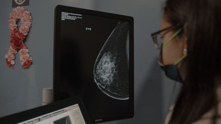 La mamografía y el ultrasonido: herramientas principales para el diagnóstico precoz en el Día Mundial contra el cáncer de ma